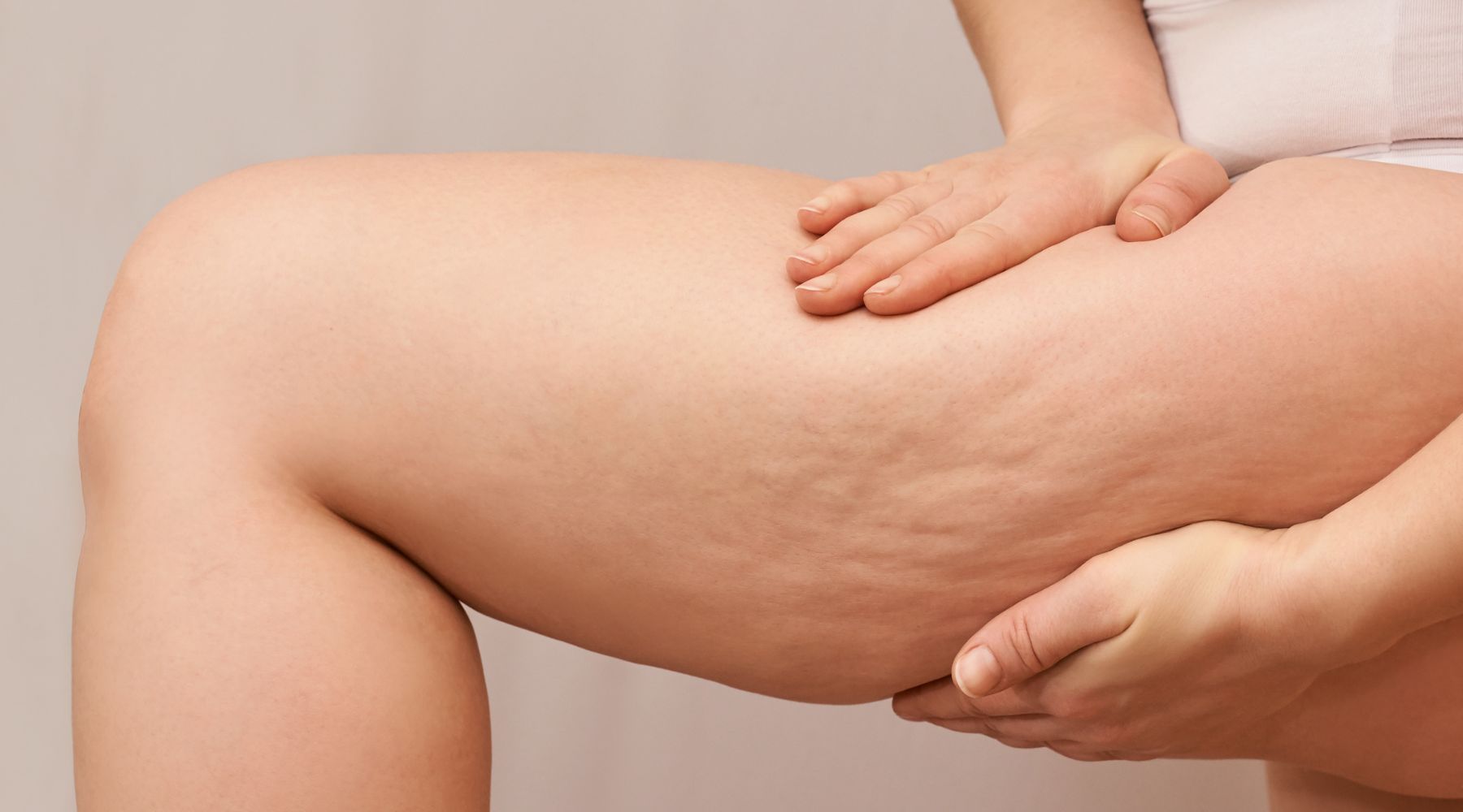 Are Compression Boots Good for Cellulite?