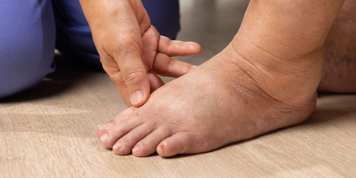 Compression Boots for Lymphedema — Proactive Recovery